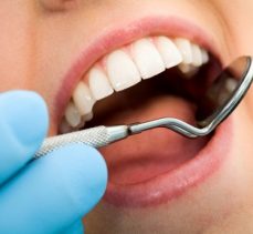 Oruçluyken Diş Tedavisi Yapılabilir