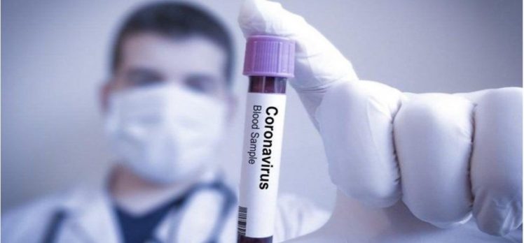 Kanser Hastaları Koronavirüsten Nasıl Korunmalıdır?
