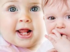 Bebeklerde Diş Çıkarma Dönemine Dikkat!